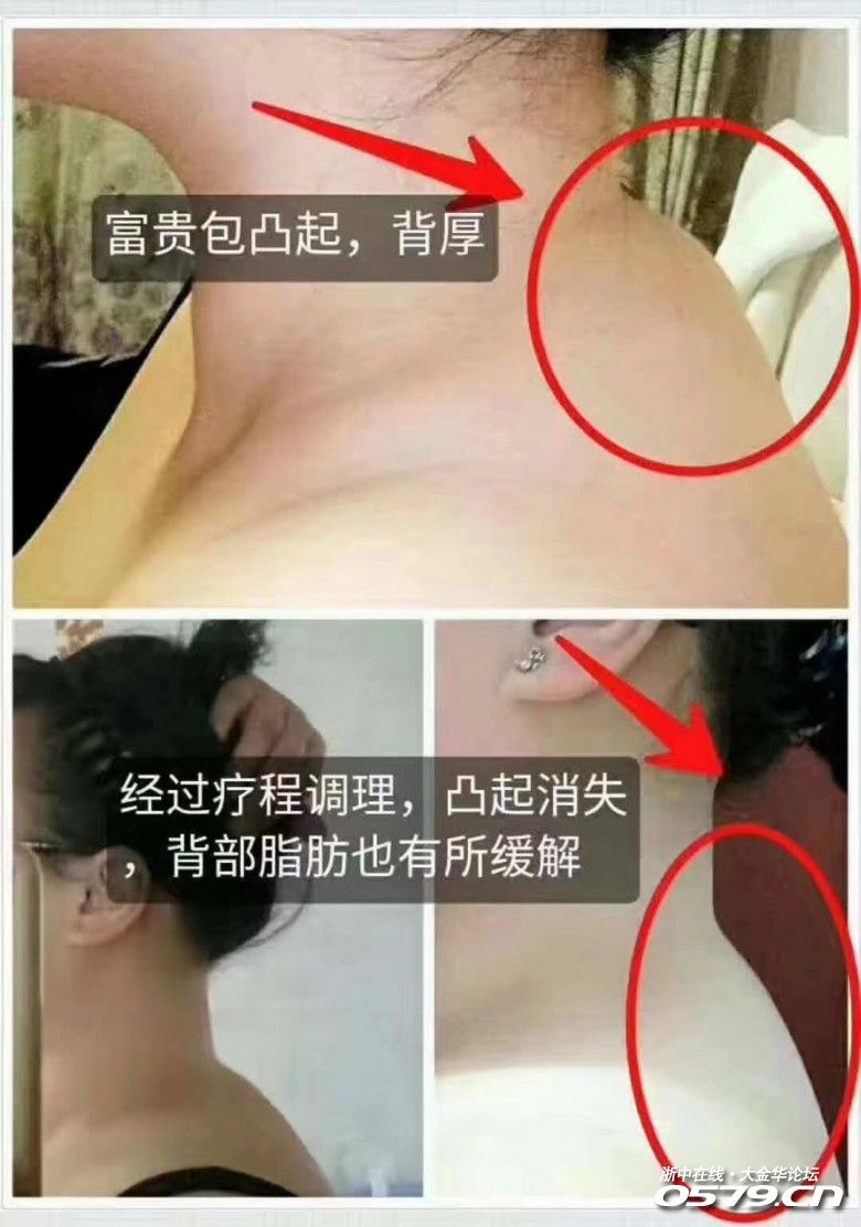 8_3246682_5e4b7247e31b9cf.jpg?80