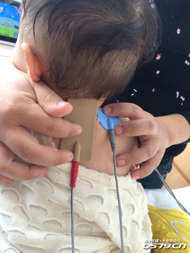 臂丛宝宝急需您的帮助,为她的未来撑起一片蓝天!