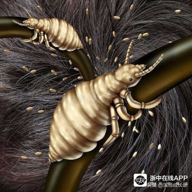 有多少见过虱子